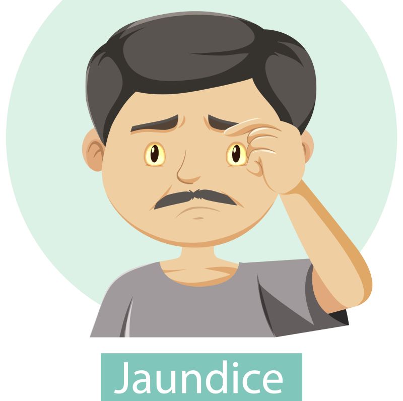 Is Jaundice a Complication of Diabetes? Diabetes Support